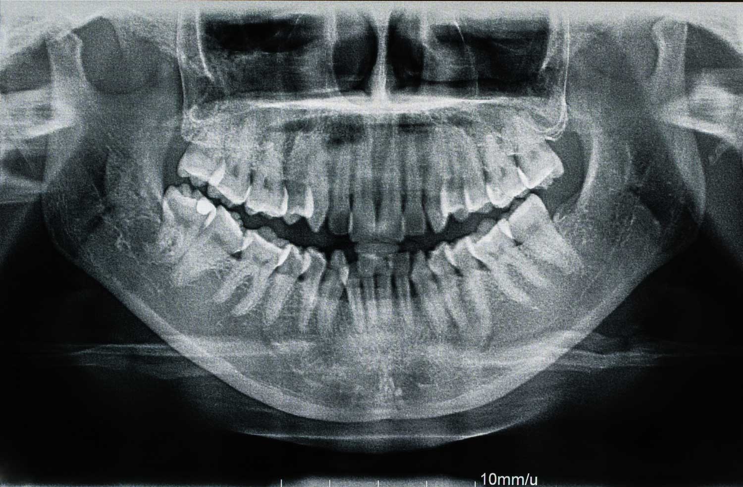 tecnología de vanguardia en Barcelona y Gavá, centro odontológico de referencia en Barcelona y Gavá, clínica dental en Barcelona y Gavá, dentista en Barcelona y Gavá.